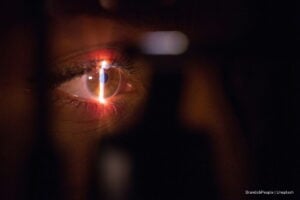 lesiones de la córnea, lesiones de la córnea en ciudadanos, Más Colombia