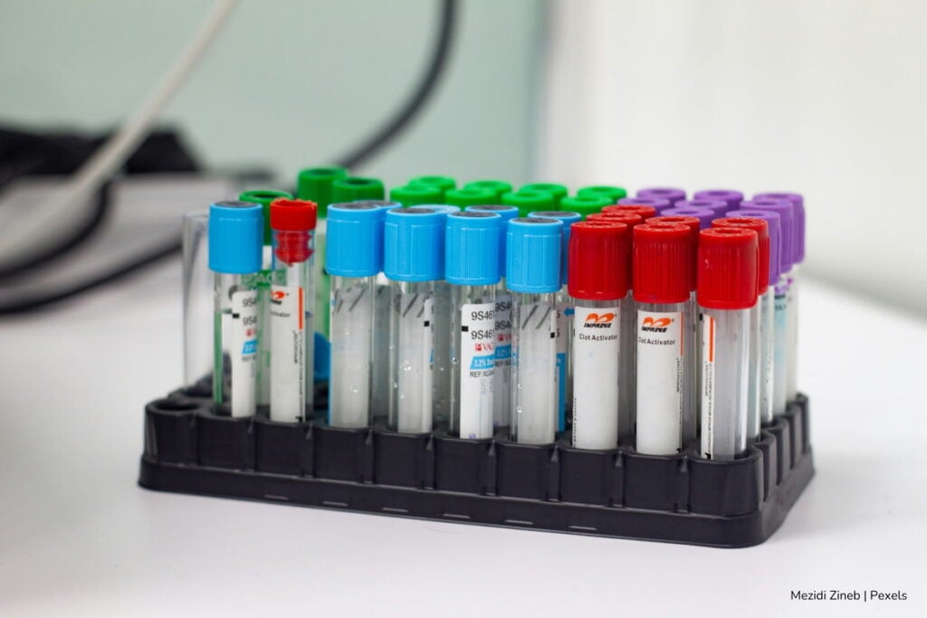 Estudio de la UNAL alerta sobre aumento de casos de dengue en 2025 si no se refuerzan las medidas de prevención 2 casos de dengue en 2025, Pruebas médicas para detectar dengue en personas, Más Colombia