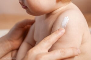 rutinas de cuidado, prevenir irritaciones, Limpieza diaria y rutinas de cuidado básicas para la piel del bebé, Más Colombia