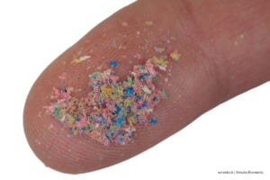 microplásticos en el cuerpo, microplásticos en el cuerpo, incluso en el cerebro,, Más Colombia