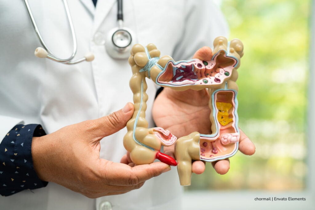 ¡Póngale cuidado a su panza! Las bacterias del intestino son las que podrían mandar en su memoria y en su vejez 2 bacterias del intestino, microbioma intestinal, Más Colombia